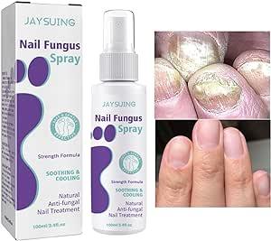 Nail Fungus Spray - Souq Sahara